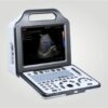 G20 PORTABLE COLOR DOPPLER DIAGNOSTIC ULTRASOUND SYSTEM